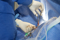 Cardiologie Interventionnelle Lyon Nord