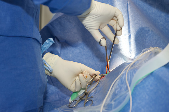 Cardiologie Interventionnelle Lyon Nord