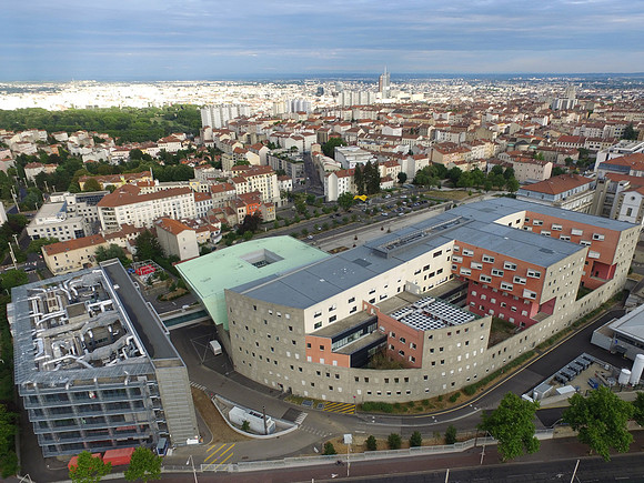 Cardiologie Interventionnelle Lyon Nord